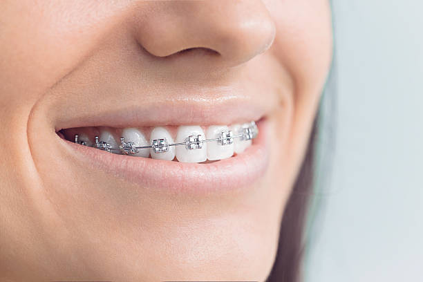 Best Invisalign and Clear Aligners  in Redwood Valley, CA